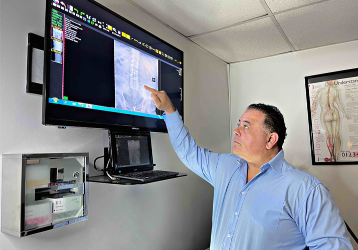Chiropractor Belleville NJ Michael Chillemi X Ray Chiropractor Belleville NJ Michael Chillemi X Ray