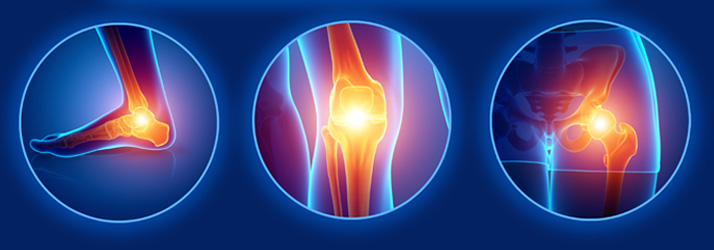 Chiropractic Belleville NJ Sciatica Chiropractic Belleville NJ Sciatica