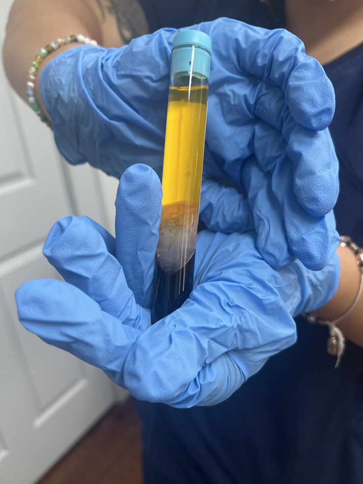 Chiropractic Belleville NJ Pain Injections in Belleville NJ Chiropractic Belleville NJ Pain Injections in Belleville NJ